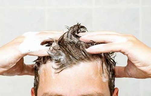 پیشگری از ریزش مو بر اثر شوره سر