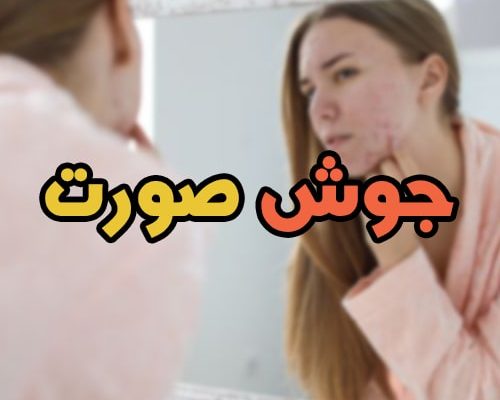 جوش صورت نشانه چیست؟ انواع آکنه + درمان قطعی به همراه عکس