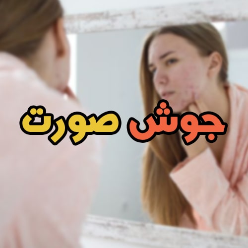 جوش صورت نشانه چیست؟ انواع آکنه + درمان قطعی به همراه عکس