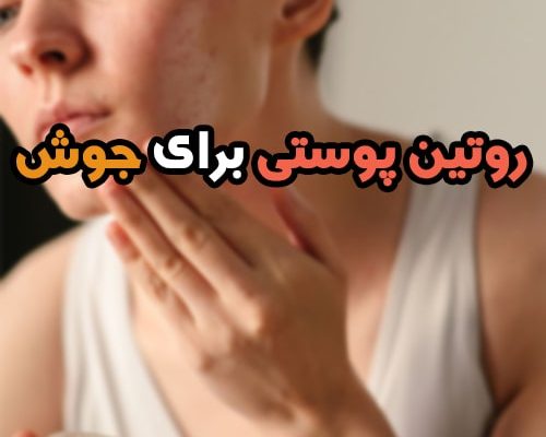 روتین پوستی برای از بین بردن جوش و جای جوش با 5 مرحله