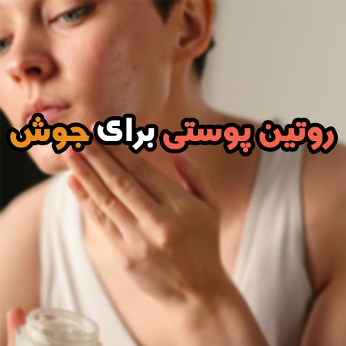 روتین پوستی برای از بین بردن جوش و جای جوش با 5 مرحله