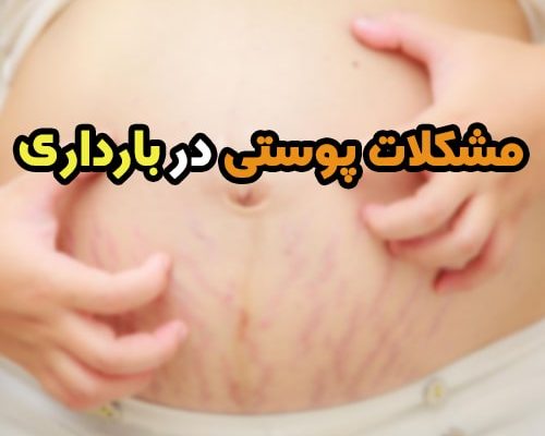 مشکلات پوستی در بارداری و بعد از آن + ارائه راه حل موثر