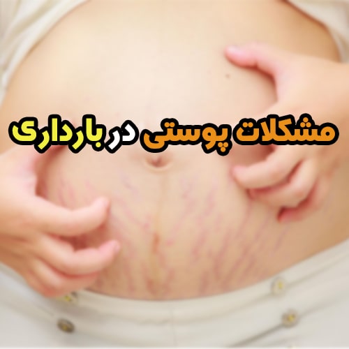 مشکلات پوستی در بارداری و بعد از آن + ارائه راه حل موثر