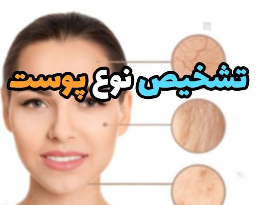 چگونه نوع پوست خود را تشخیص دهیم؟ ساده ترین راهنمایی + راهکار