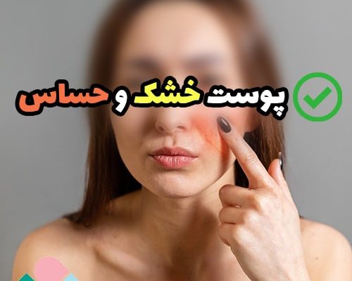 درمان پوست خشک و حساس؛ روش های تضمیمنی + روتین پوستی