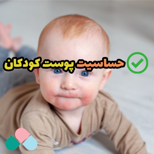 حساسیت پوست کودک؛ علت و راهکار درمان