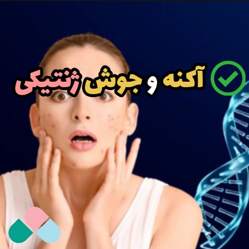 آکنه و جوش ژنتیکی؛ تاثیر ژنتیک بر ابتلا به آکنه