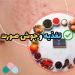 تغذیه و جوش صورت