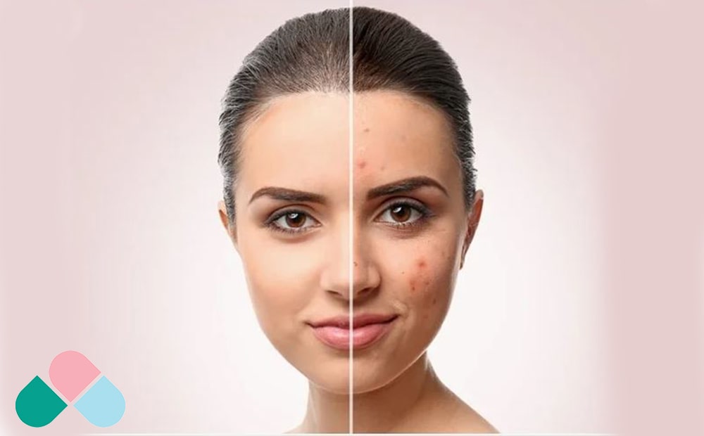 مراقبت_های تکمیلی