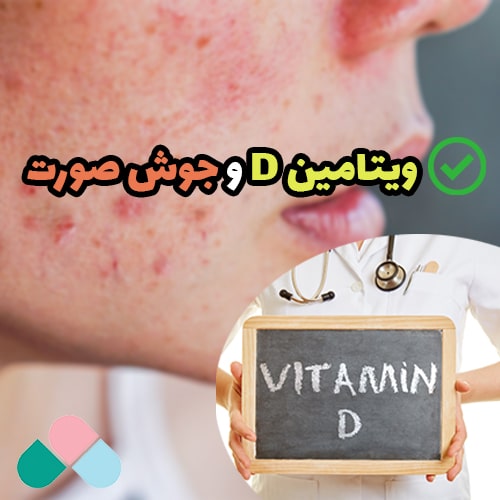 آیا کمبود ویتامین دی باعث جوش صورت میشود؟