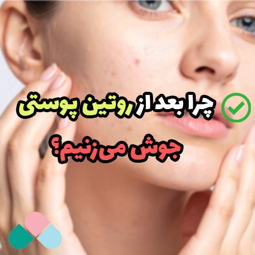 چرا بعد از روتین پوستی جوش می‌زنیم؟ بررسی علمی!