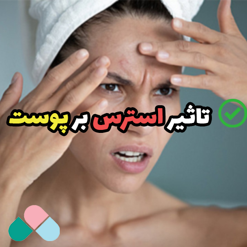 تاثیر استرس بر پوست صورت؛ از جوش تا تیرگی پوست!