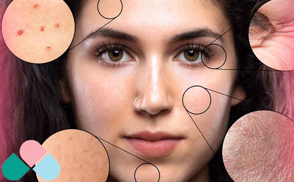 تاثیر ترک سیگار بر پوست