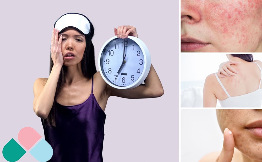 تاثیر دیر خوابیدن بر پوست