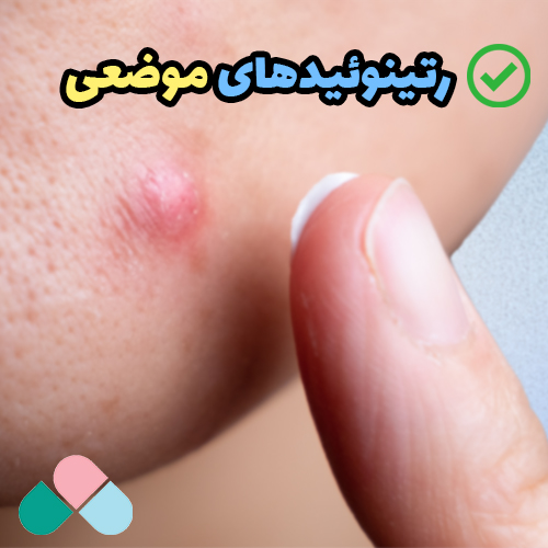 رتینوئیدهای موضعی چیست؟ انواع رتینوئید موضعی برای جوش