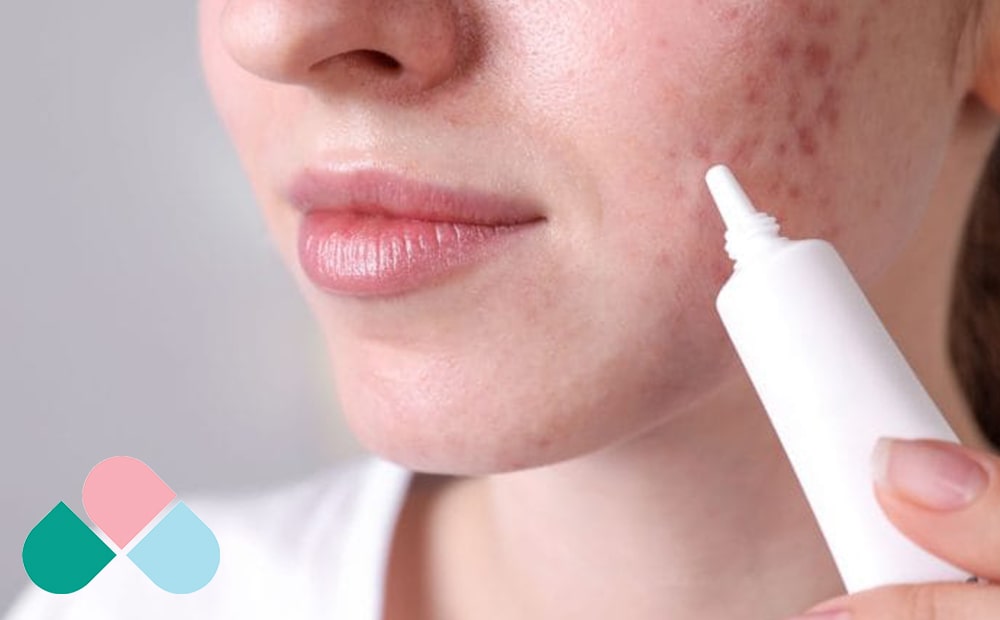 کنترل چربی پوست