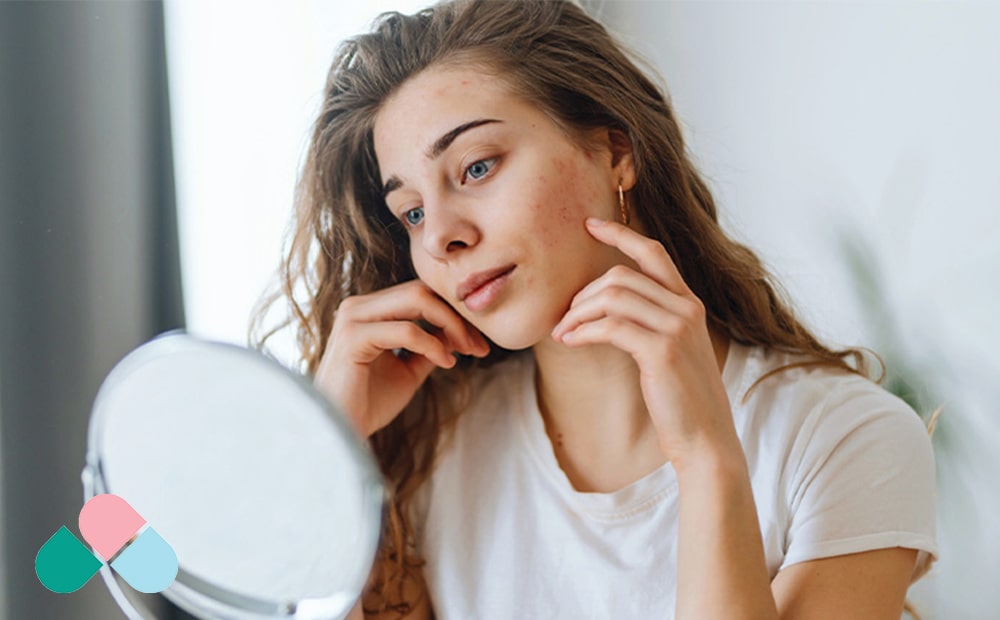 کنترل جوش ها به روش صحیح